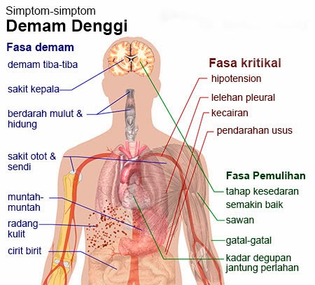 demam-denggi-akmalyaziz.com-2